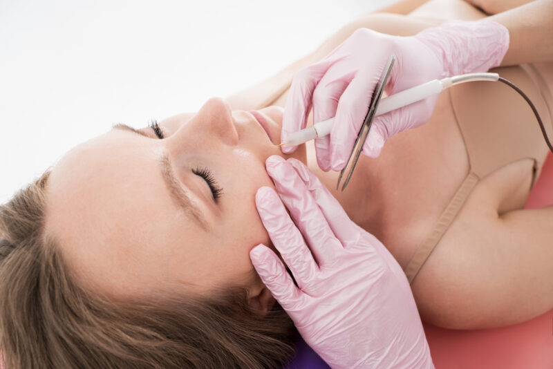 Woman receiving electrolysis on her face