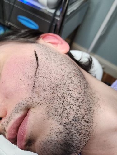 Progressive accelerated electrolysis carousel image 1