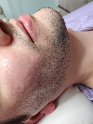 Progressive accelerated electrolysis carousel image 2