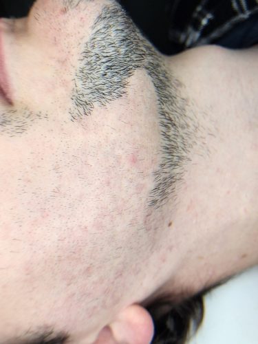 Progressive accelerated electrolysis carousel image 3