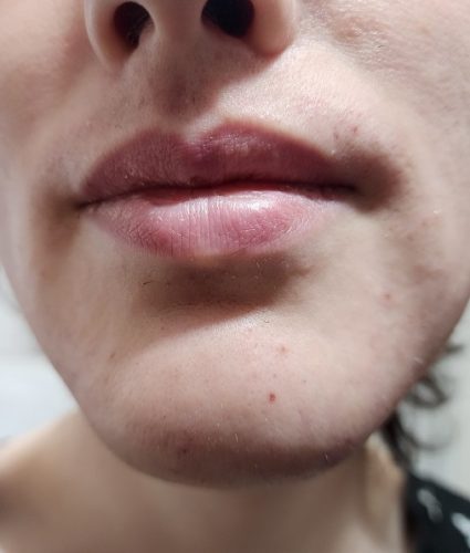 Progressive accelerated electrolysis carousel image 9