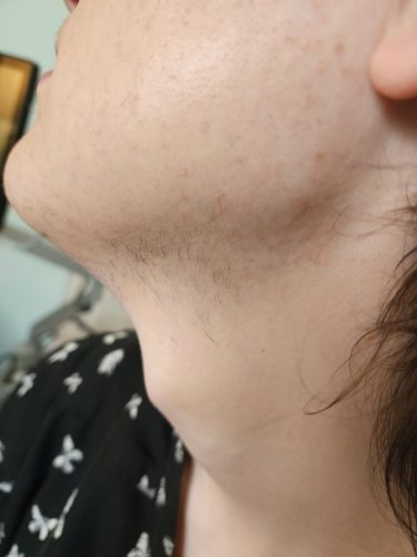 Progressive accelerated electrolysis carousel image 8