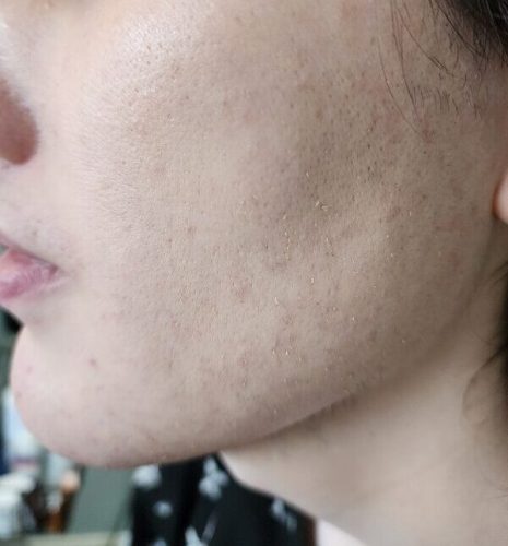 Progressive accelerated electrolysis carousel image 7