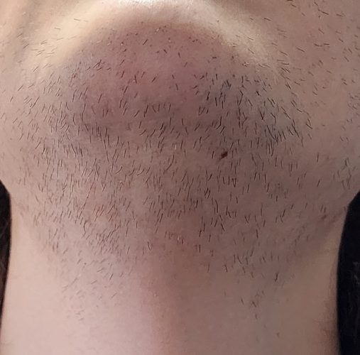 Progressive accelerated electrolysis carousel image 13