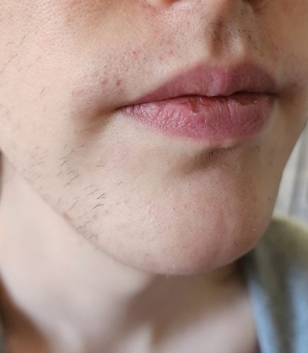 Progressive accelerated electrolysis carousel image 14