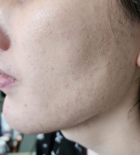 Progressive accelerated electrolysis carousel image 11