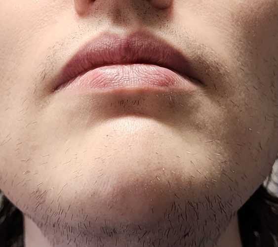 Progressive accelerated electrolysis carousel image 15