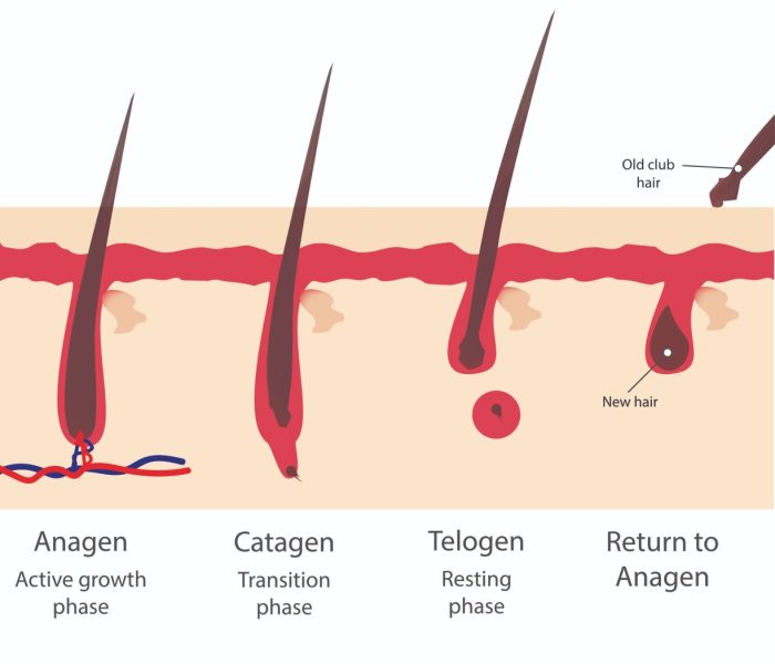 Anagen, catagen and telogen hair-growth cycles